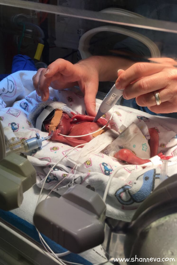 Support is the number one thing you need in the NICU