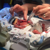 Why support is the most important thing during a NICU stay