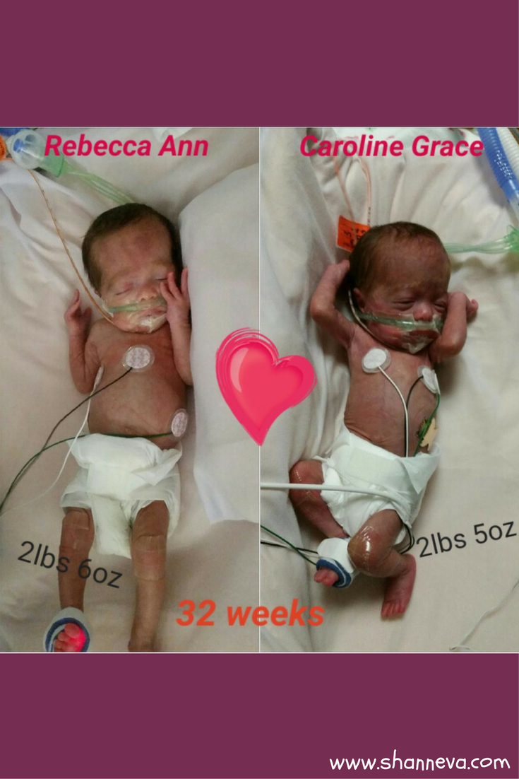 Mono Mono Twins Caroline And Rebecca S Story Shann Eva S Blog