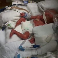 emergency c-section