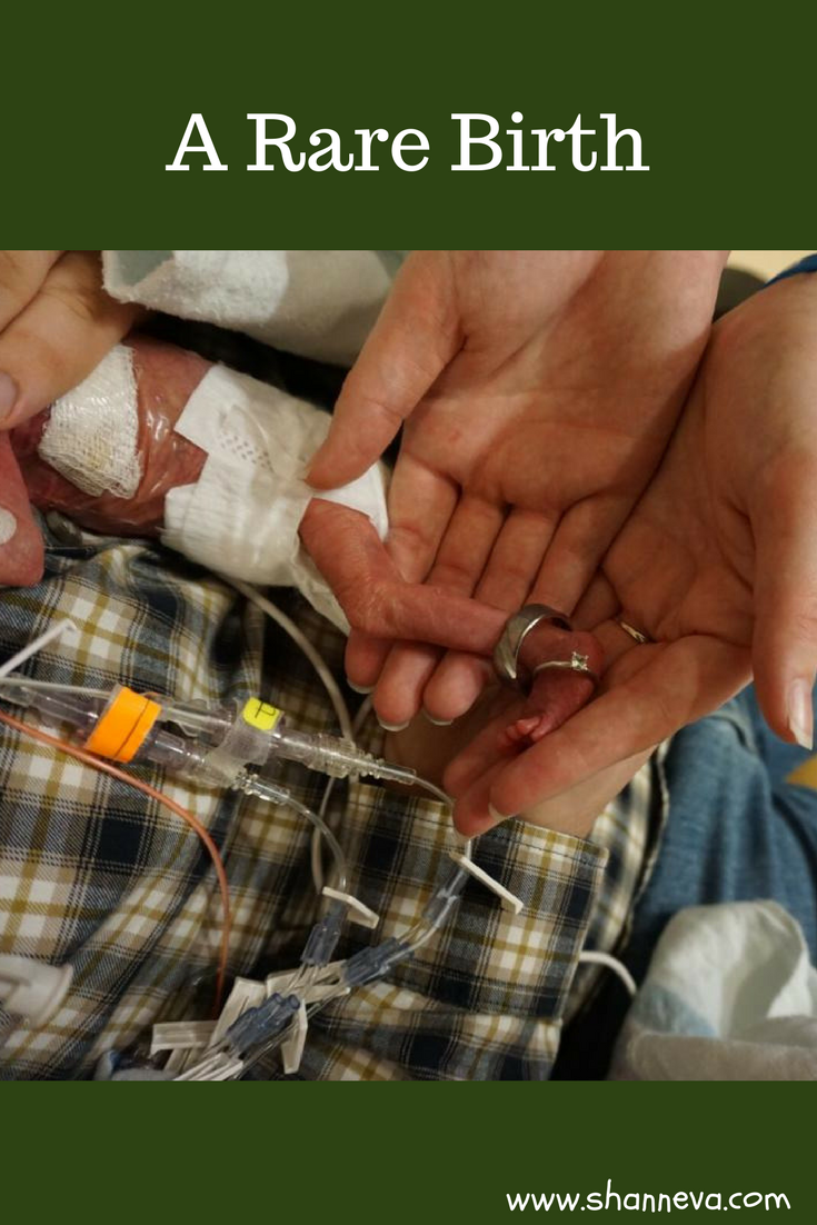 #rarebirth A unique birth leads to an amazing micro preemie #micropreemie #nicu