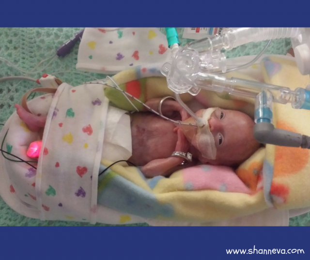 Born at 21 weeks Meet a Rockstar Shann Eva's Blog